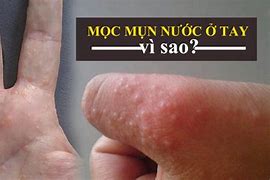 Cách Làm Tay Chân Nước Ở Mỹ